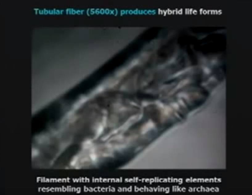Morgellon-Tubular-fiber