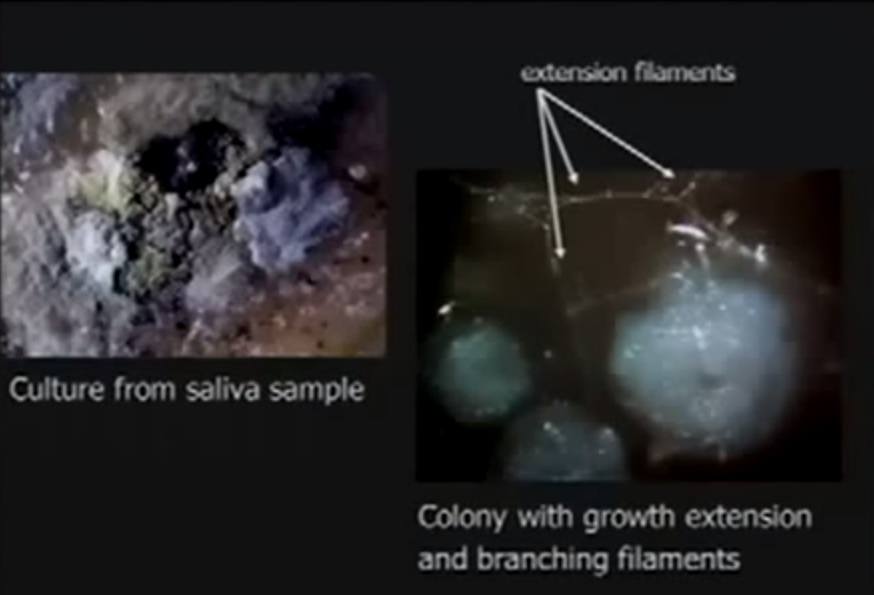 Morgellons-Culture-from-saliva-sample