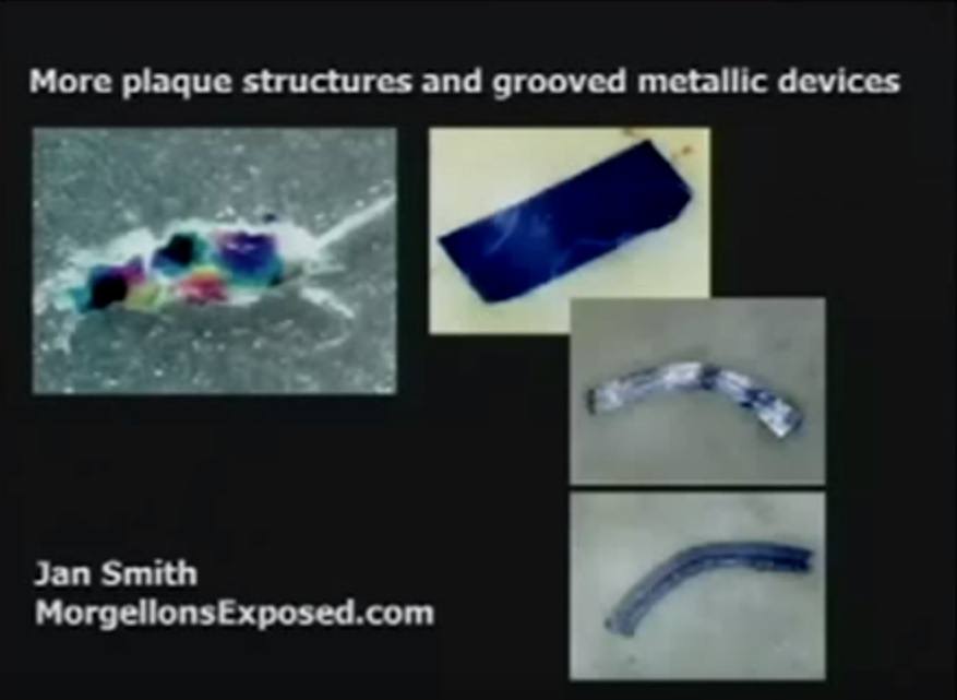 Morgellons-plaque-structures
