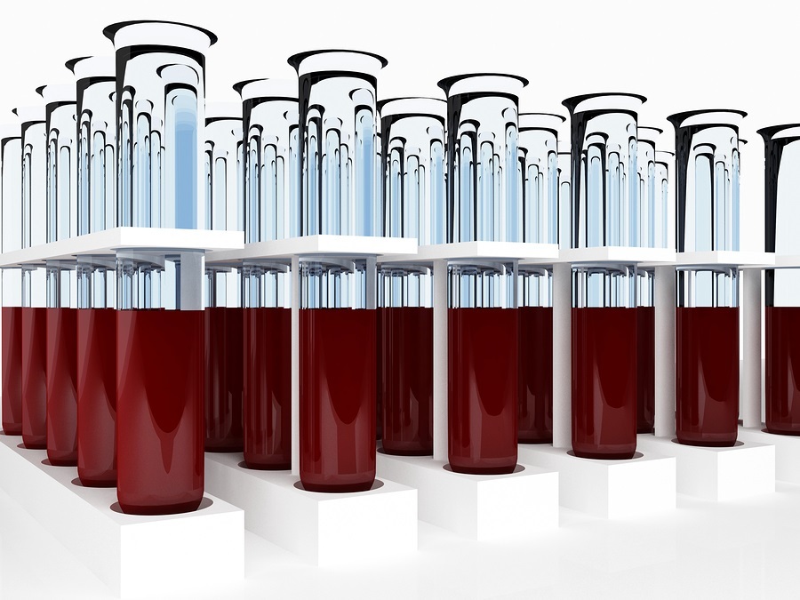 Many test tube with blood for analysis