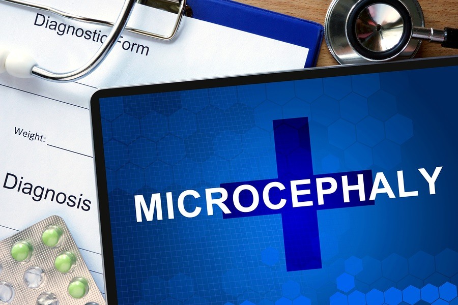 Diagnosis Microcephaly and tablets on a wooden table.