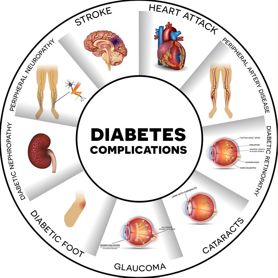 Diabetes complications affected organs. Diabetes affects nerves kidneys eyes vessels heart brain and skin. Round info graphic.