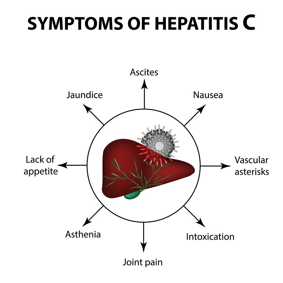 Natural and Nontoxic Options for Treating Hepatitis C or