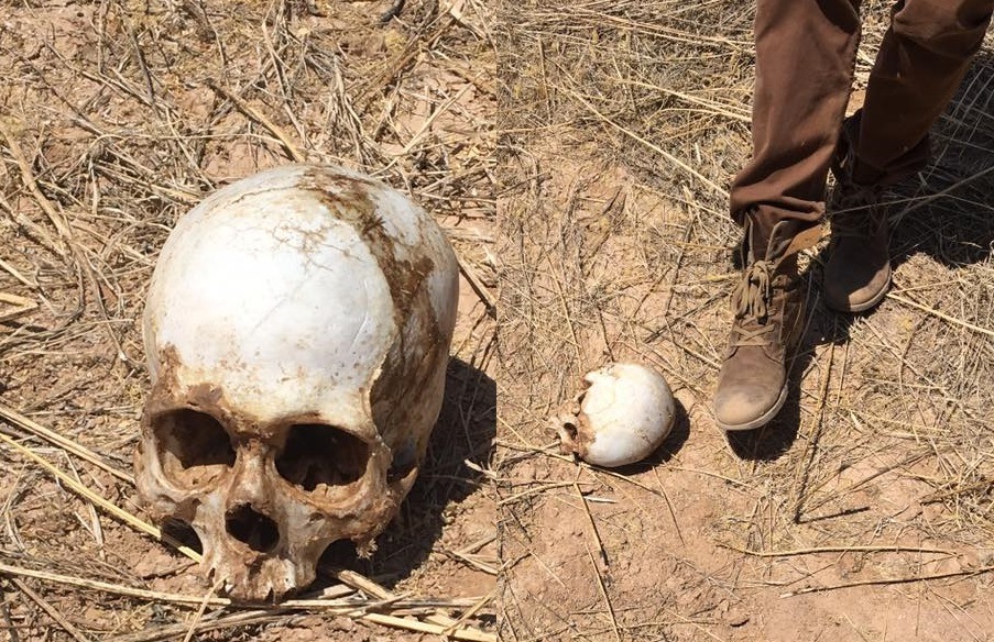 Child skull Arizona VOP