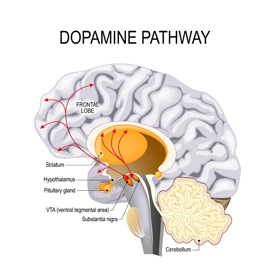 Dopamine pathway dysfunction illustration.