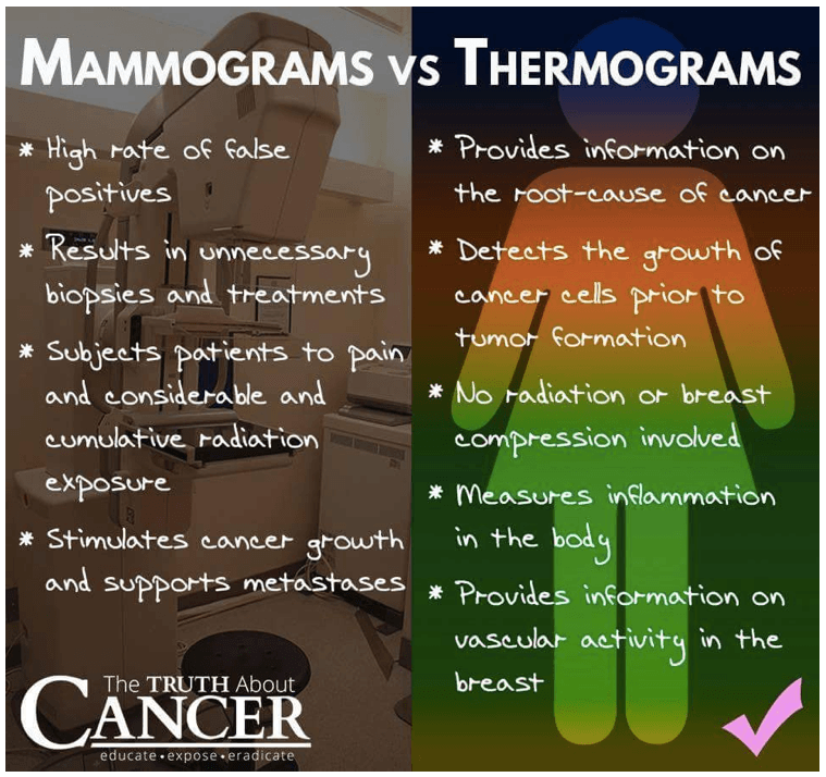 Thermography vs. Mammography for Early Breast Cancer Detection: Who ...