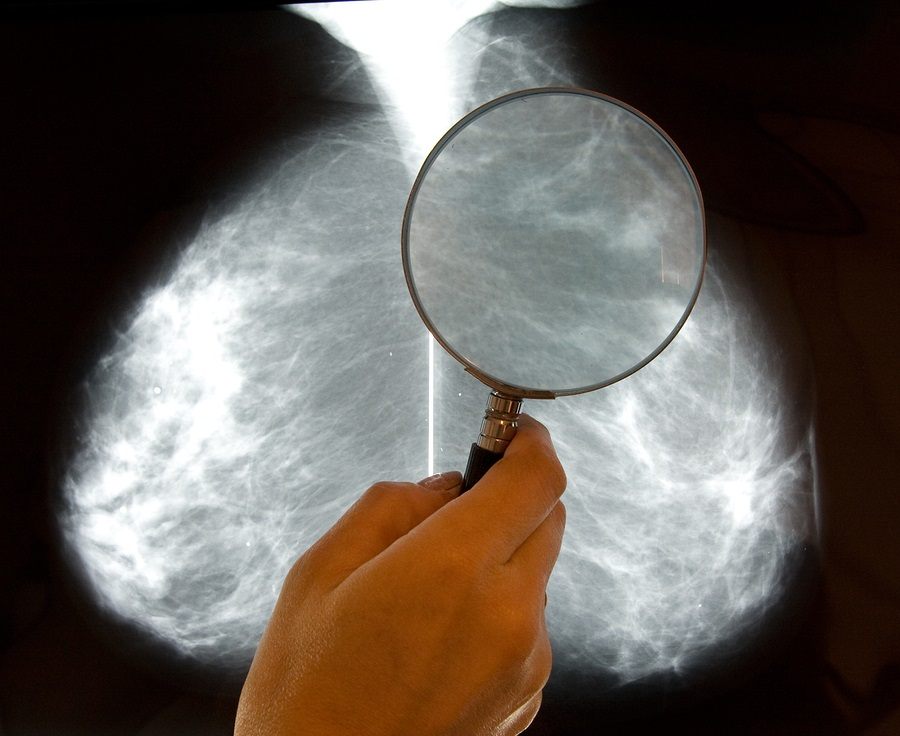 doctor examining mammography x-ray pictures image