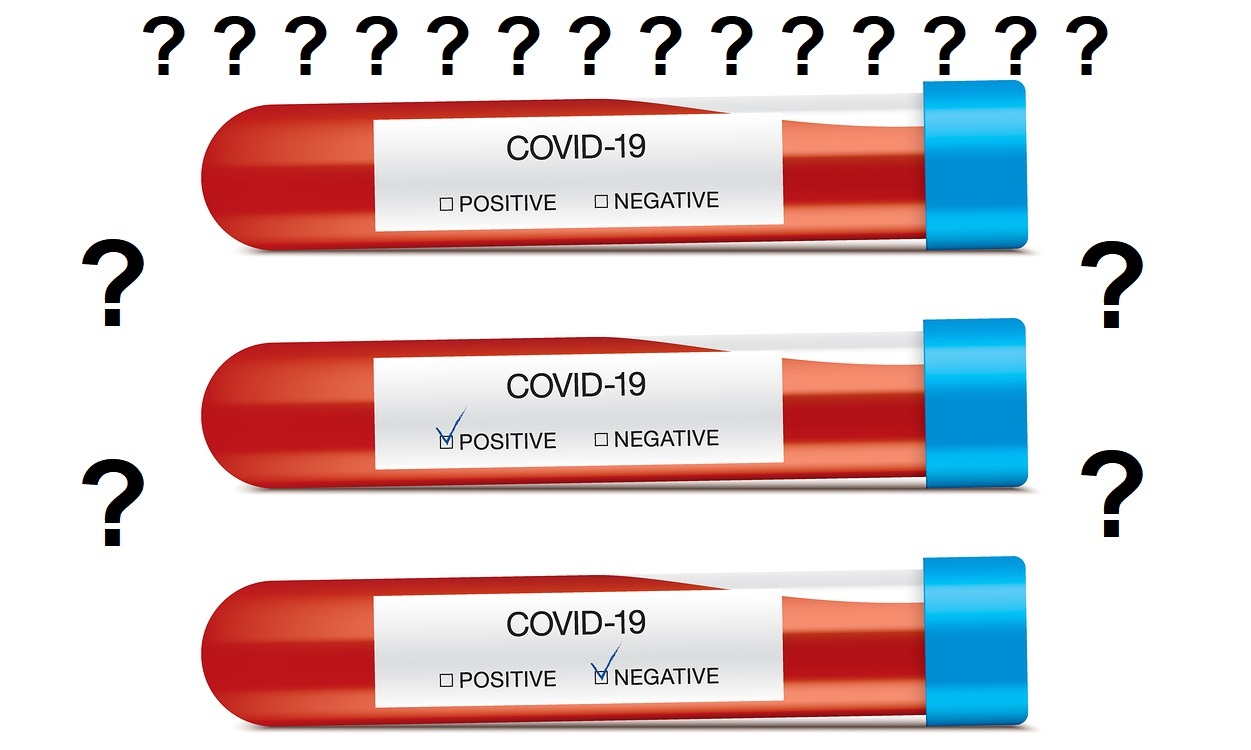 COVID-19 blood analysis, with different answers. Set of glass capsules field with patient blood and white information labels.