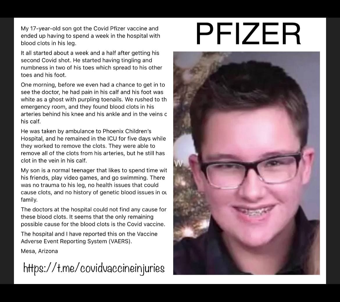 COVID Shots Are Killing and Crippling Teens in Record Numbers – Young Children Are Next Mesa-arizona-17-years-old-blood-clots