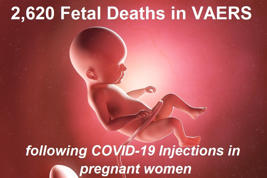 2,620 Dead Babies in VAERS After COVID Shots – More Fetal Deaths in 11 Months than Past 30 Years Following ALL Vaccines as Scotland Begins Investigation