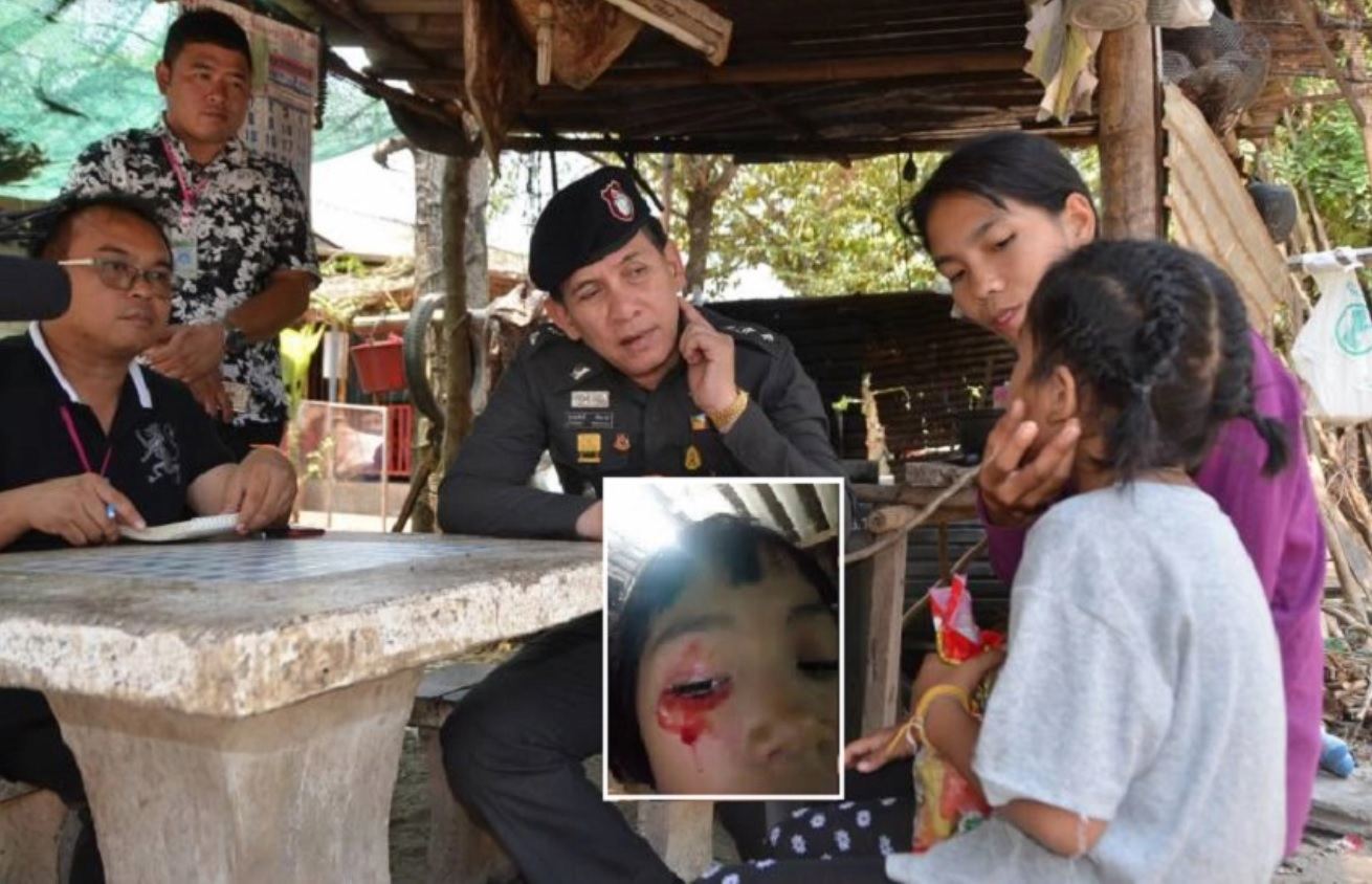 7 year old girl eye bleed Thailand