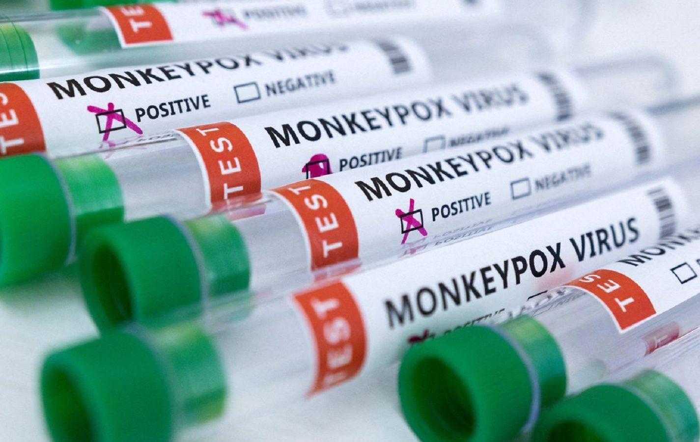 monkeypox-tests-1425x900