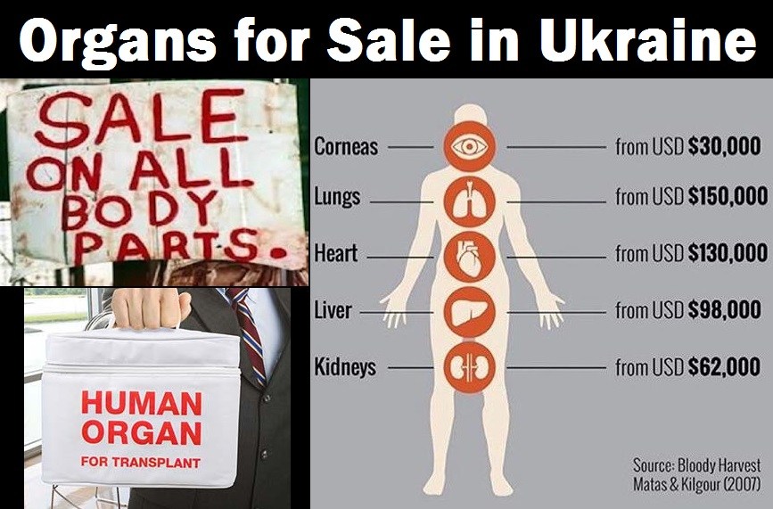 Organs for Sale in Ukraine