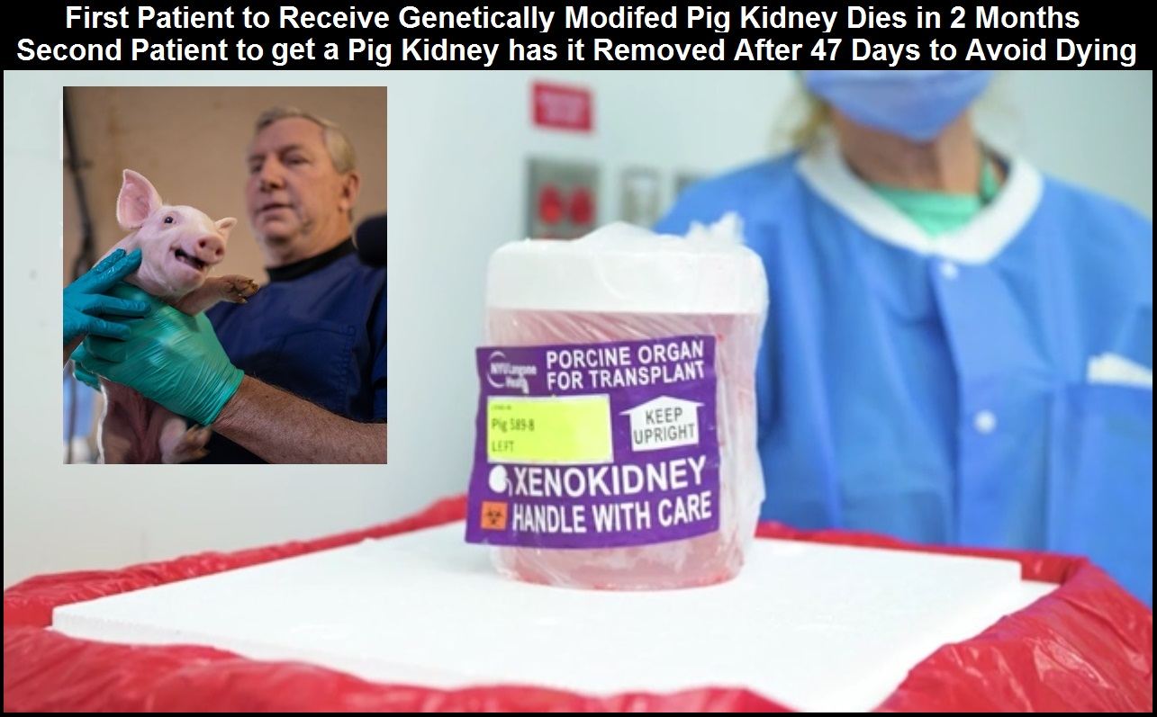 Pig to human kidney transplant results 2